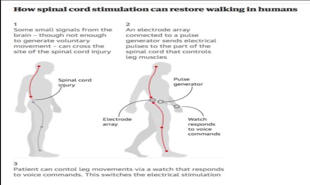 How epidural stimulation works